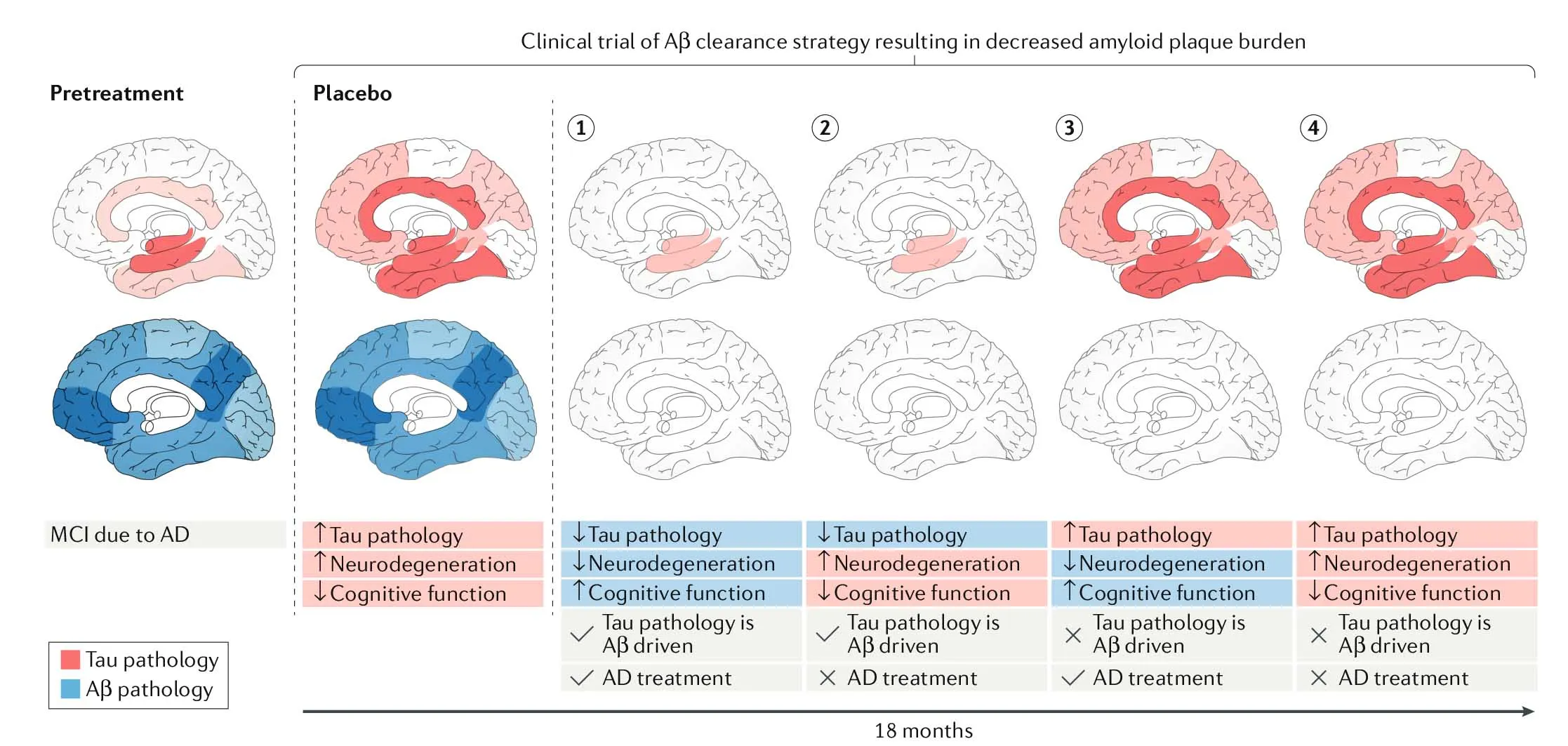 Testing the amyloid-cascade hypothesis in clinical trials combining Aβ-removing therapies and tau PET. (1) This scenario might be the ultimate proof of the cascade hypothesis. (2) This result would provide evidence that Aβ drives tau pathology, though will not find a cure, indicating that something is still missing in our understanding. (3) This result would support the dual-stream hypothesis, also indicating that some mechanism acts upstream of both Aβ and tau. The use of both Aβ and tau targeting therapies might then result in a cure. (4) This outcome would also fit the dual cascade hypothesis, and perhaps a tau hypothesis, indicating that Aβ has no effect on degeneration. Original figure from van der Kant, Goldstein & Ossenkoppele, 2019.